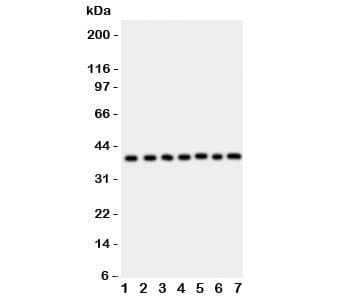 ARA9 / AIP Antibody (aa91-330)