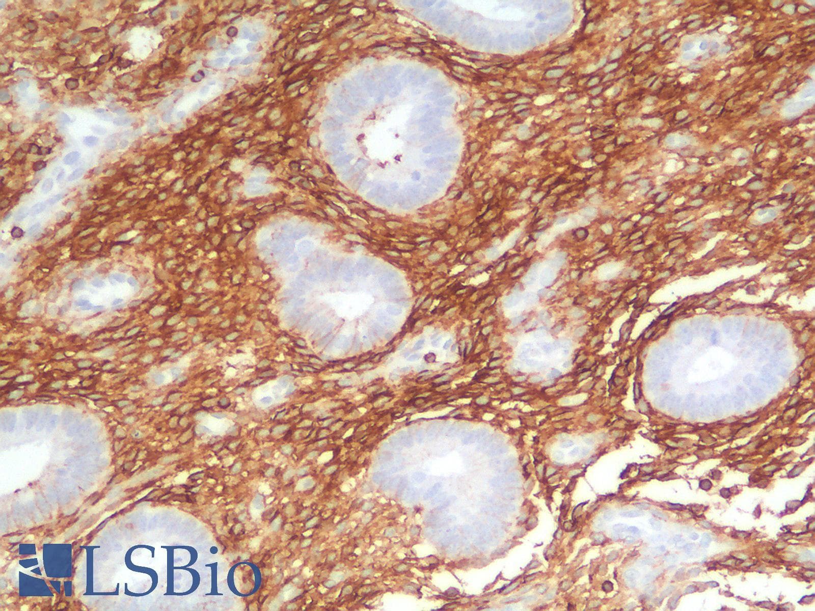 PathPlus™ CD44 Antibody (clone HCAM/2875R)