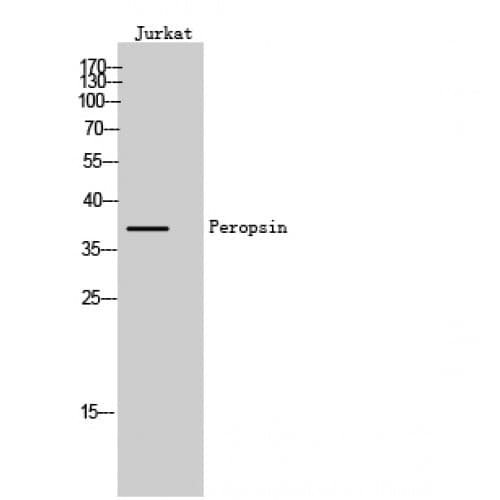 Peropsin / RRH Antibody (180-260 aa, Internal)