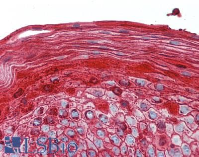 IgA1 Antibody