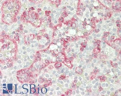 IHC-plus™ Monoclonal Mouse anti-Human CD8A / CD8 Alpha Antibody (clone C8/144B, Azide-free,BSA-free, C-Terminus, IHC, IF)