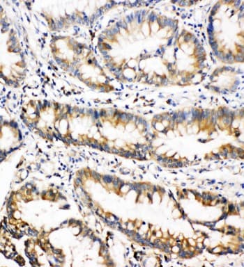 Polyclonal Rabbit anti-Human OSM / Oncostatin M Antibody (aa181-198, IHC, WB)