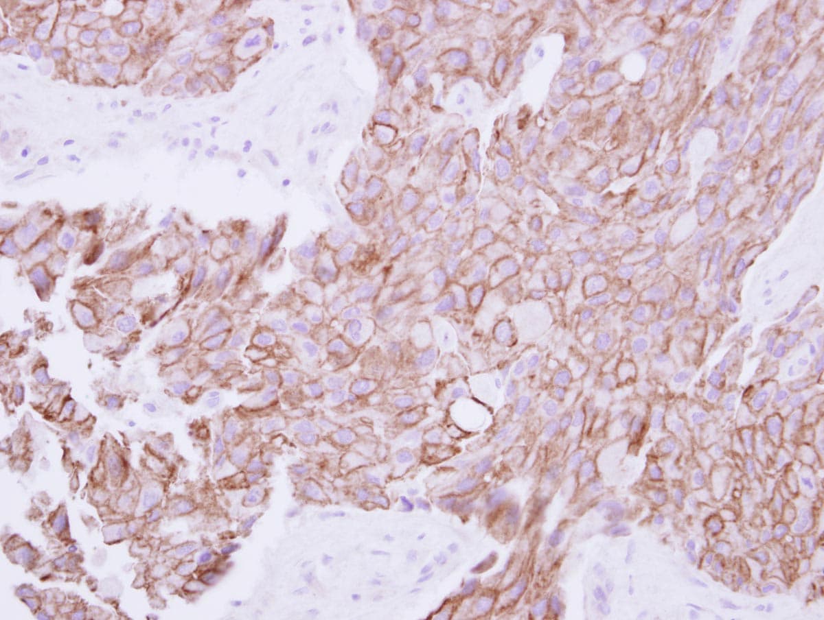 TMPRSS11B Antibody