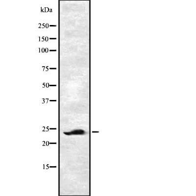 EF1B / EEF1B2 Antibody