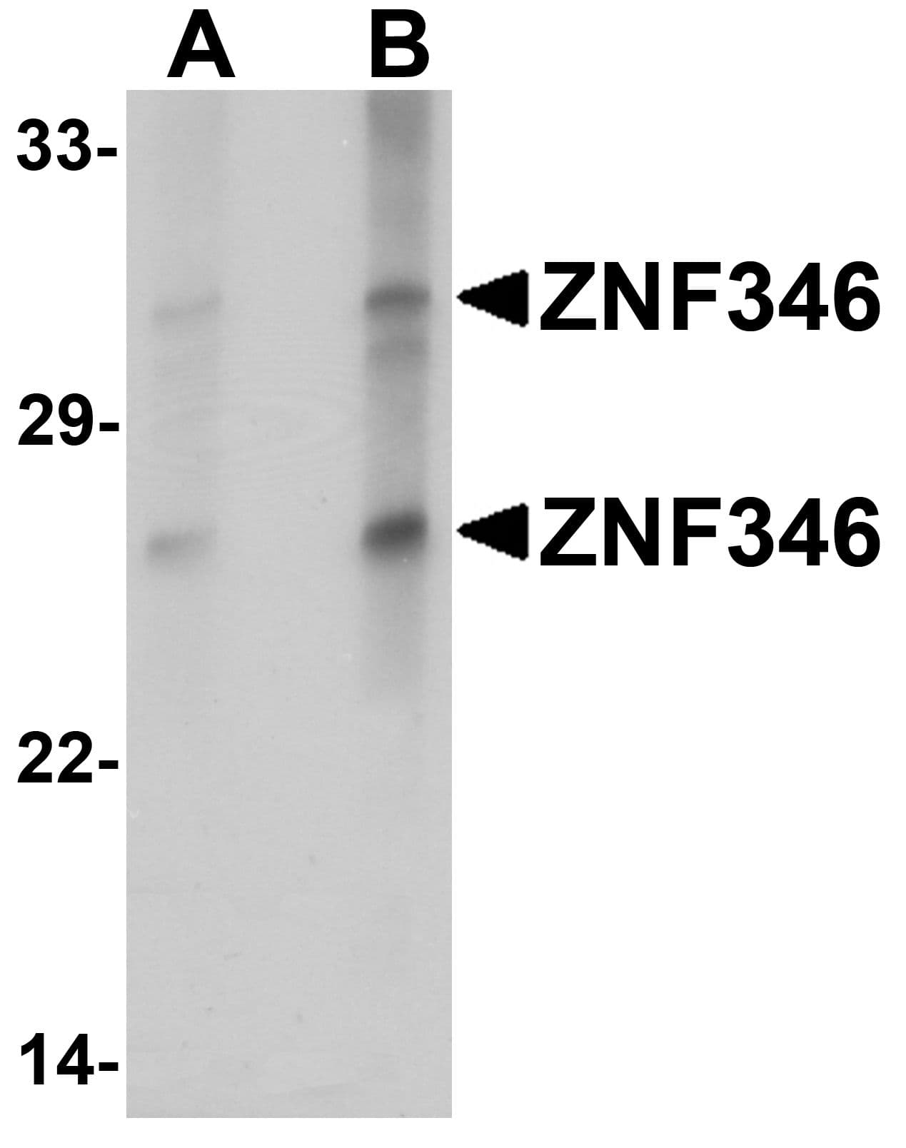 IHC-plus™ Polyclonal Rabbit anti-Human ZNF346 Antibody (IHC, IF, WB)