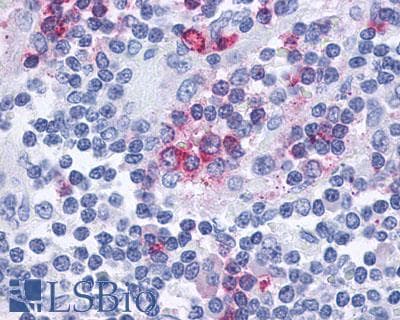 PathPlus™ Polyclonal Rabbit anti-Human CCR10 / GPR2 Antibody (C-Terminus, IHC)