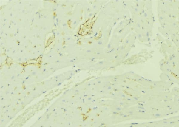 TBRG4 Antibody