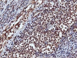 AKT1 Antibody (clone OTI4E10)