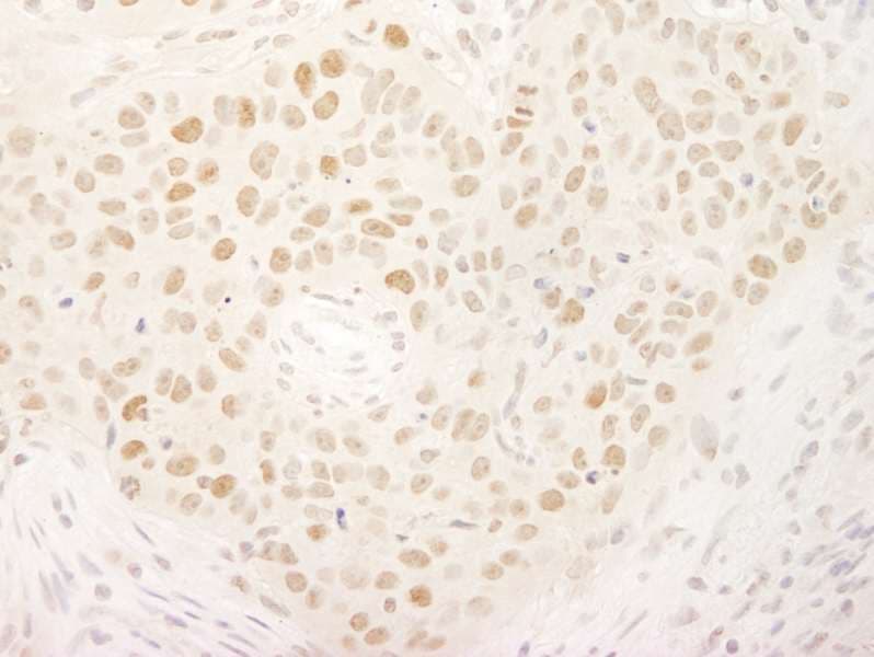 Polyclonal Rabbit anti-Human HSET / KIFC1 Antibody (aa1-50, IHC, WB)