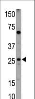 BNIP1 Antibody (aa92-127)