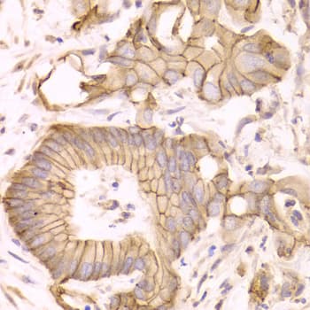 CTNND1 / p120 Catenin Antibody