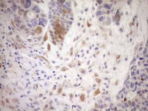 p16INK4a / CDKN2A Antibody (clone OTI7A6)