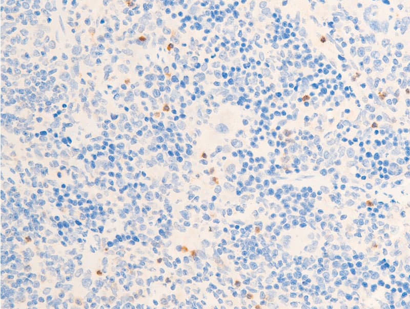 Polyclonal Rabbit anti-Human CHEK1 / CHK1 Antibody (phospho-Ser317, IHC, IF, WB)