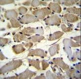 ZMYND17 Antibody (aa402-430)