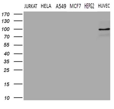 TGM2 / Transglutaminase 2 Antibody (clone OTI1C4)