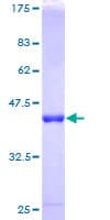 Human RABIF Protein (Recombinant GST)