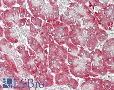 KLB / Beta Klotho Antibody (aa517-636)