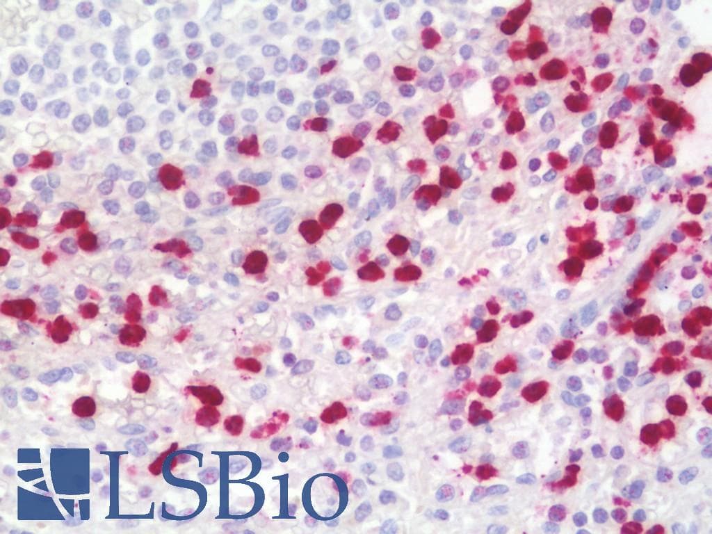 LCN2 / Lipocalin 2 / NGAL Antibody (HRP)