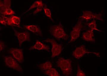CAMK4 / CaMK IV Antibody