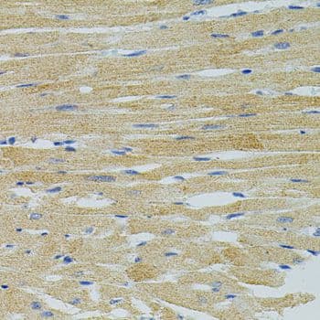 Polyclonal Rabbit anti-Human APG5 / ATG5 Antibody (IHC)