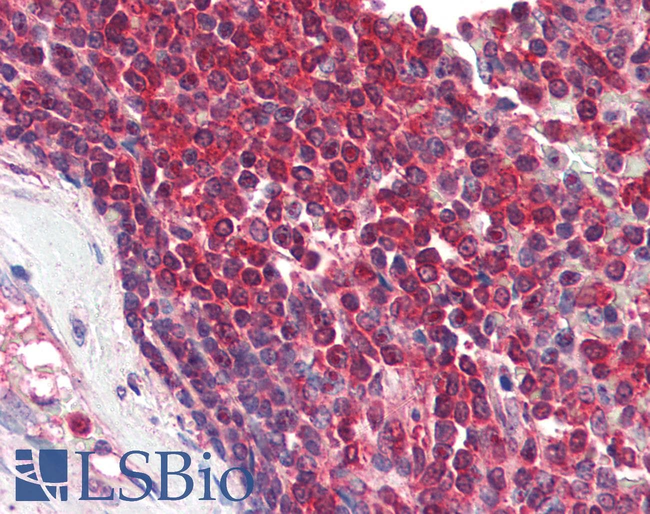 IHC-plus™ DAGLA Antibody (aa1031-1042)