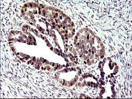 Monoclonal Mouse anti-Human PMS2 Antibody (clone OTI4B7, IHC, WB)