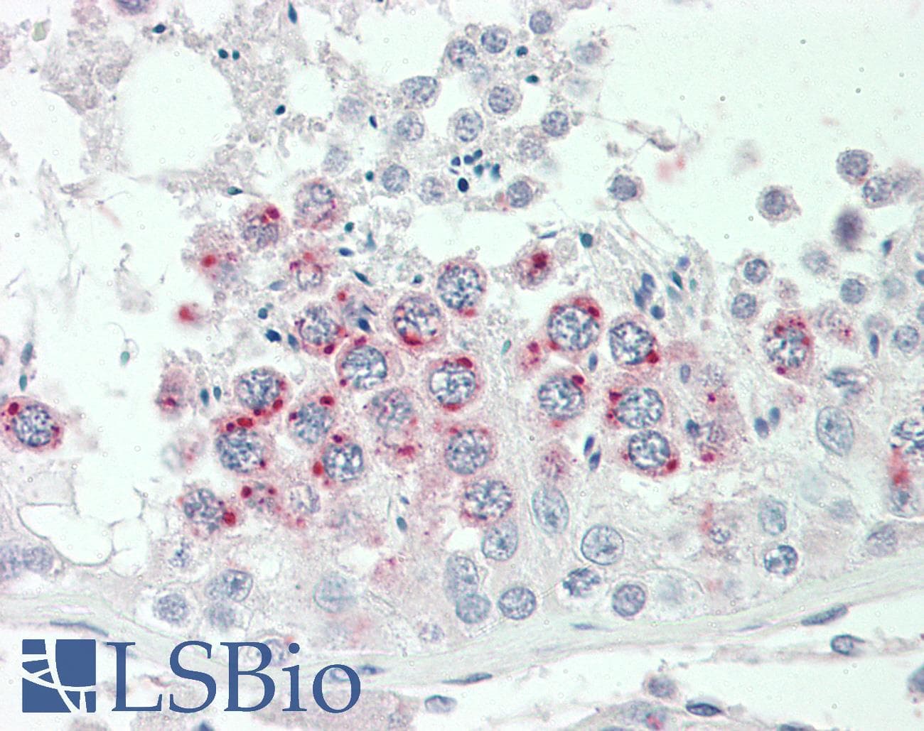 IHC-plus™ Polyclonal Goat anti-Human SPINT2 / HAI-2 Antibody (aa111-122, IHC, WB)