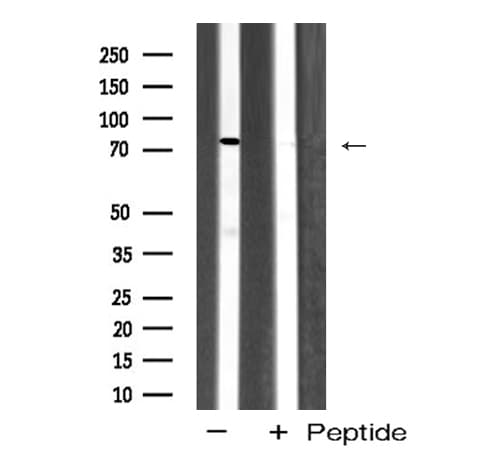 DAXX Antibody