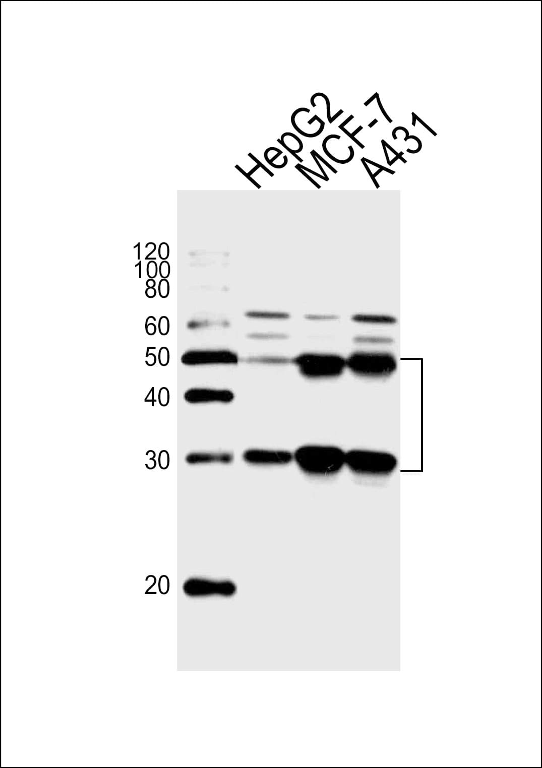 CTSD / Cathepsin D Antibody