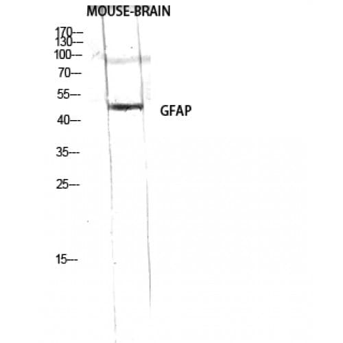 GFAP Antibody (30-110 aa)