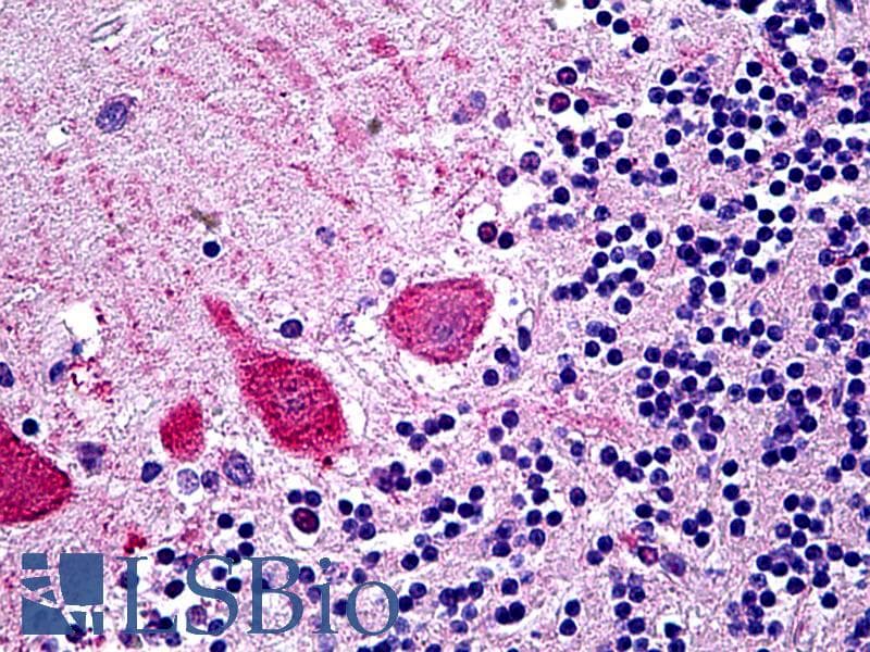 IHC-plus™ LIN41 / TRIM71 Antibody (aa390-402)