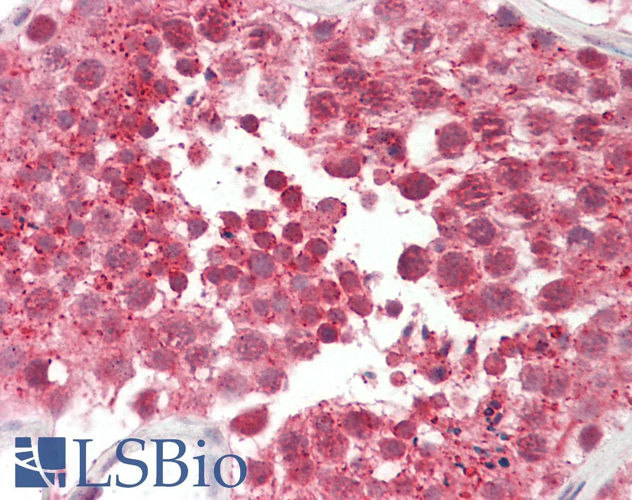 CILD9 / DNAI2 Antibody (aa71-120)