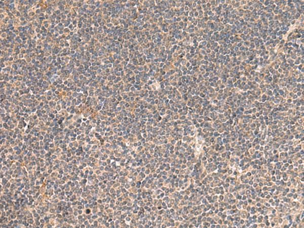 Polyclonal Rabbit anti-Human KCNE3 Antibody (IHC)