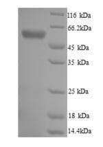 Trypanosoma cruzi TPR Protein (Recombinant 6His, N-terminus)
