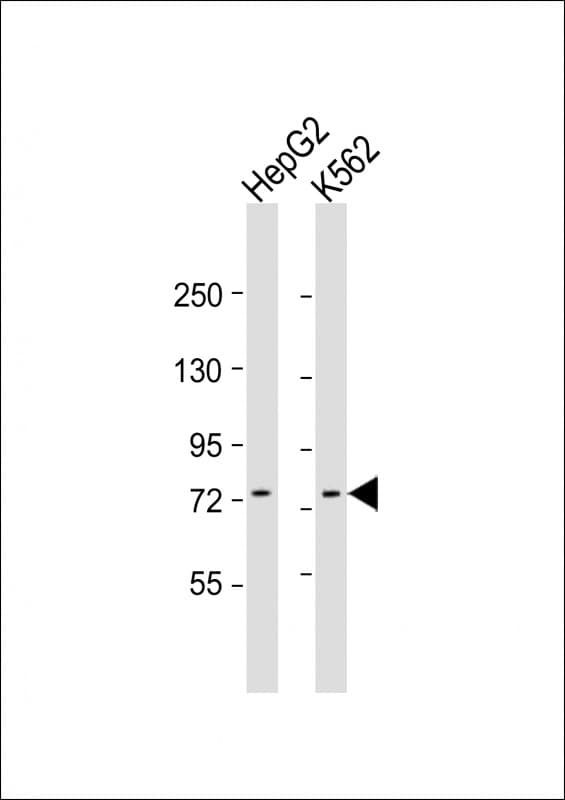 Polyclonal Rabbit anti-Human GTPBP4 Antibody (aa477-510, WB)