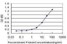 IRAK4 / IRAK-4 Antibody (clone 2D3)