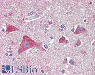 IHC-plus™ Polyclonal Rabbit anti-Human VNN1 Antibody (IHC, WB)