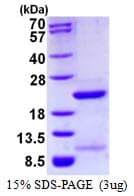 Human FUBP1 Protein (Recombinant His)
