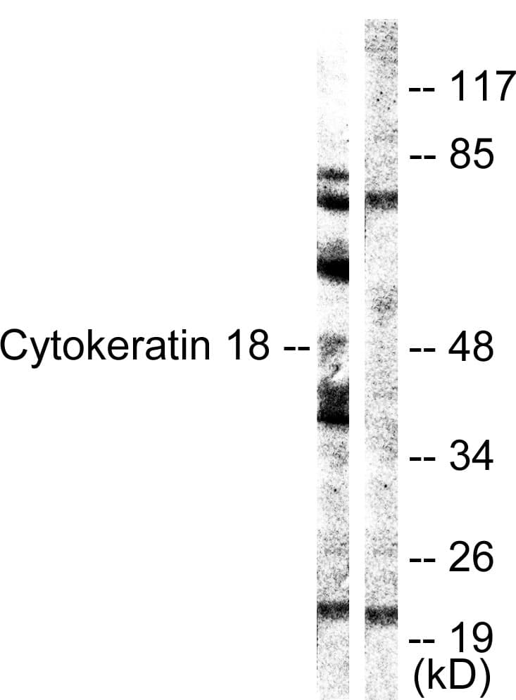 KRT18 / CK18 / Cytokeratin 18 Antibody (aa21-70)