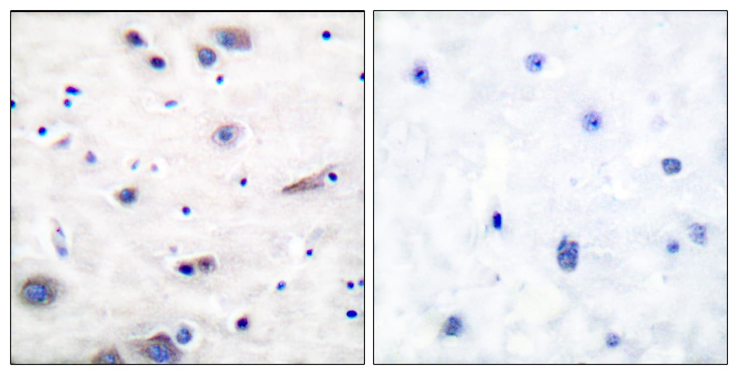 PTPN11 / SHP-2 / NS1 Antibody (phospho-Tyr580)