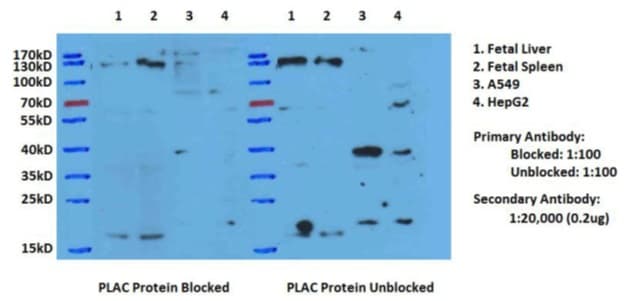 PLAC1 Antibody (aa26-192)