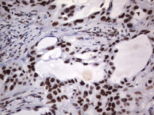 DDX56 Antibody (aa323-547, clone UMAB152)