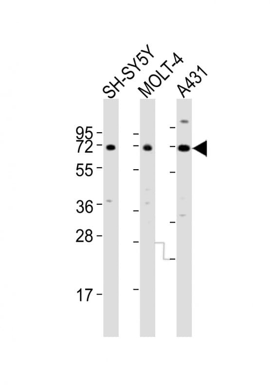 HTR2C / 5-HT2C Receptor Antibody (aa274-308)