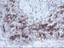 SERPINB2 / PAI-2 Antibody (clone 1G3, Carrier-free)