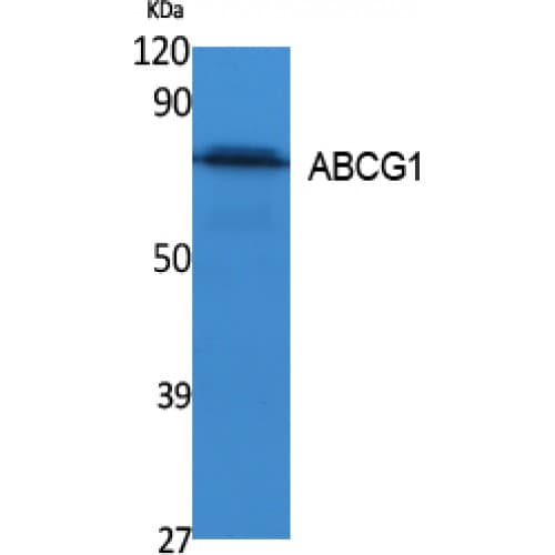 IHC-plus™ ABCG1 Antibody (560-640 aa, C-terminal)