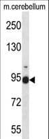 FBLN1 / Fibulin 1 Antibody (aa622-650)