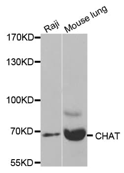 CHAT Antibody
