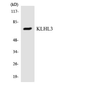 Polyclonal Rabbit anti-Human KLHL3 Antibody (aa14-63, IHC, WB)
