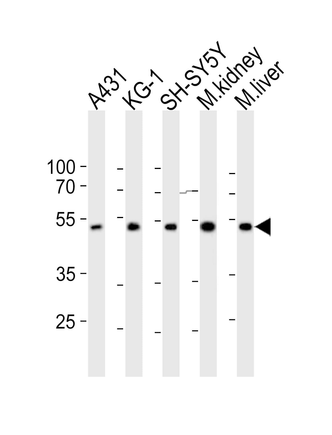 CLN3 Antibody (aa250-284)