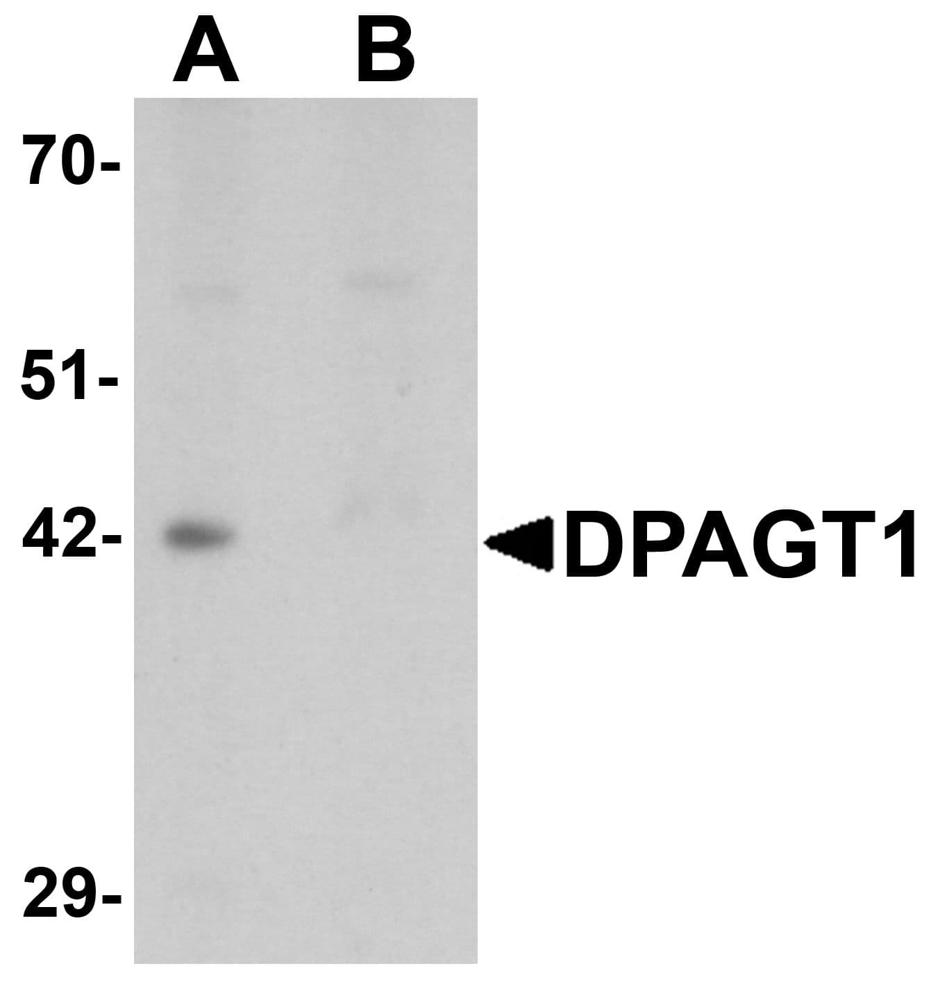 DPAGT2 / DPAGT1 Antibody
